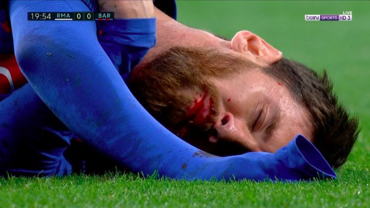 Marcelo lakťom dokrvavil Messiho. Ten potom Realu strelil dva góly! (VIDEO)