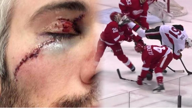 Tatarov spoluhráč takmer prišiel o oko, tvár mu prerezala korčula súpera!