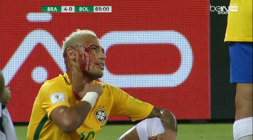 Neymar chcel dať súperovi jasličky. Skončil s dokrvavenou tvárou! (VIDEO)