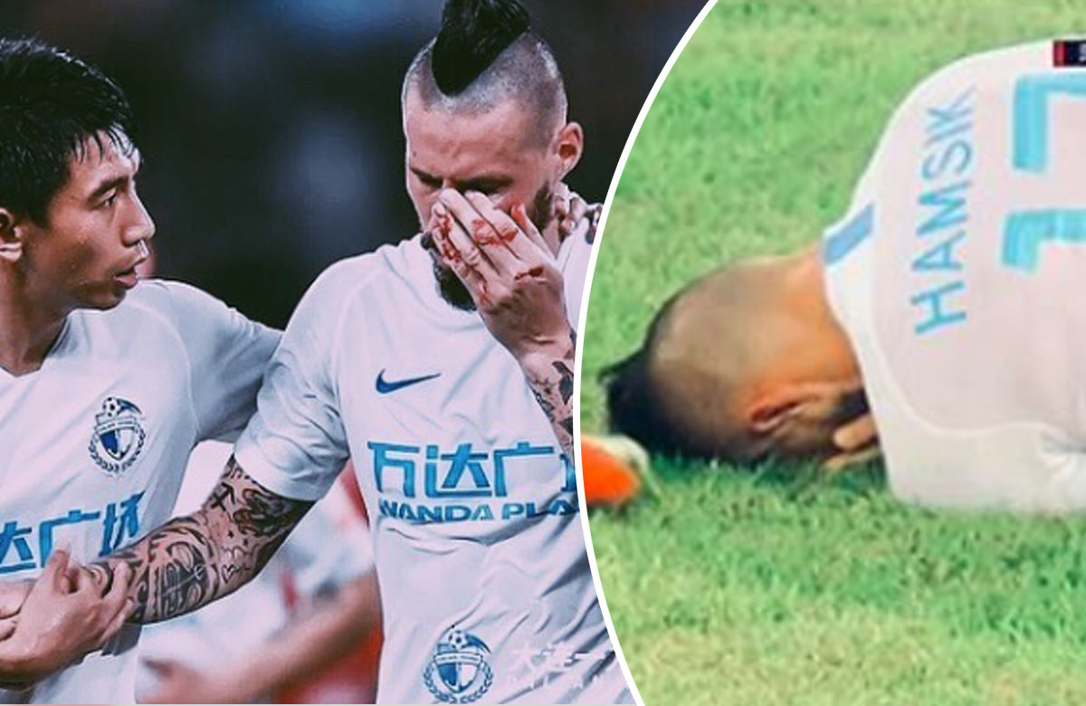 Marek Hamšík nedohral zápas v Číne. V pokutovom území dostal kopačkou do tváre! (VIDEO)