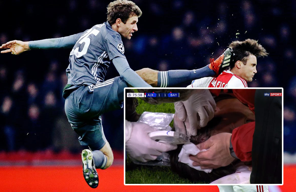 Thomas Müller s červenou kartou proti Ajaxu. Súperovi karate zákrokom kopol do hlavy! (VIDEO)