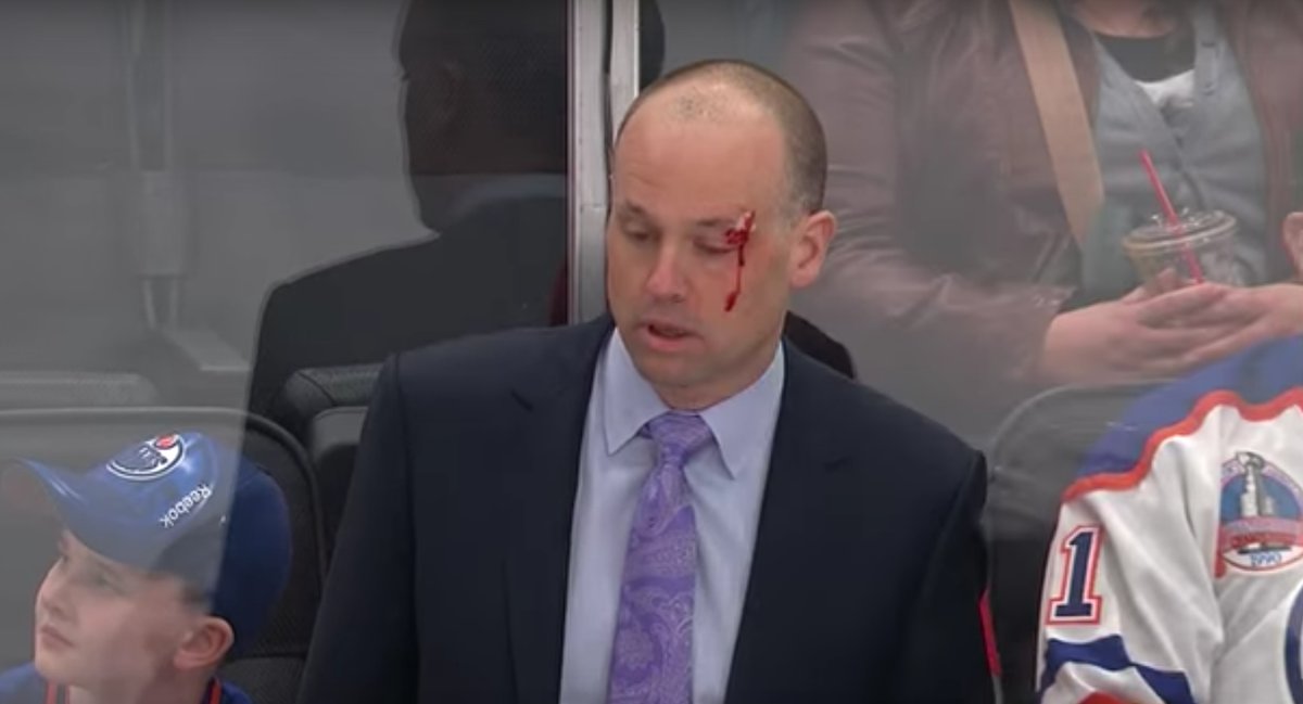 Ďalší rozdiel medzi trénerom v hokeji a futbale: Kouča Detroitu trafil puk do hlavy. Dokrvavená hlava ho vôbec netrápila! (VIDEO)