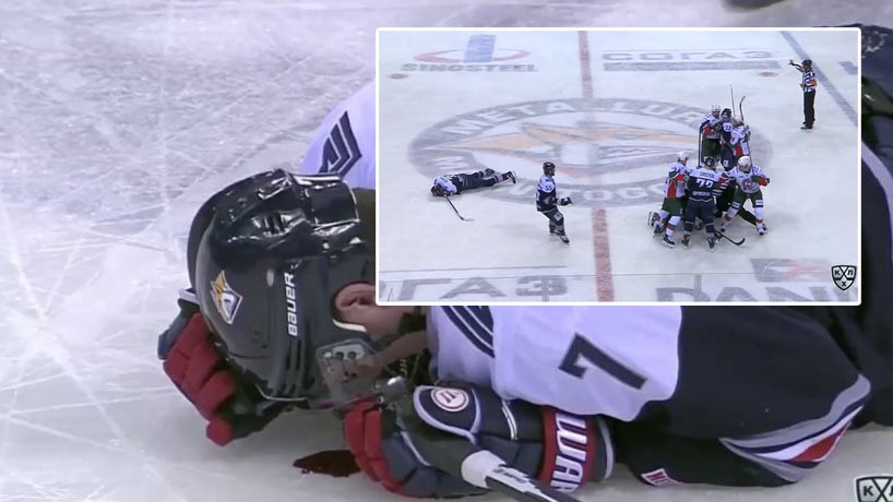 Brutálny faul v KHL: Hráč zostal ležať na ľade v kaluži krvi. Obranca Kazane dostal dodatočný trest na 8 zápasov! (VIDEO)