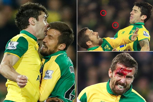 Aj futbalisti sú tvrdí chlapi: Takto dopadli dvaja hráči Norwichu, no zápas dohrali! (VIDEO)