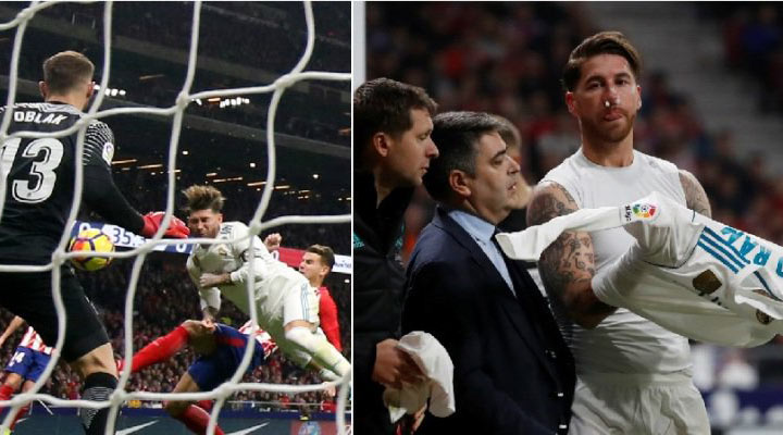 Real Madrid mal kopať jasnú penaltu. Obranca Atletica kopol Sergia Ramosa do hlavy a zlomil mu nos! (VIDEO)