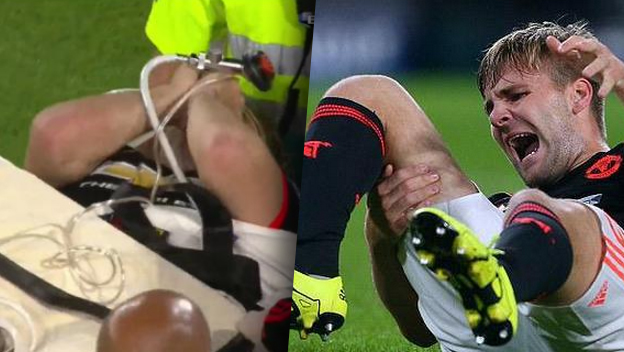 Hrôzostrašné zranenie futbalistu Manchestru United Shawa v zápase Ligy Majstrov proti PSV (VIDEO)