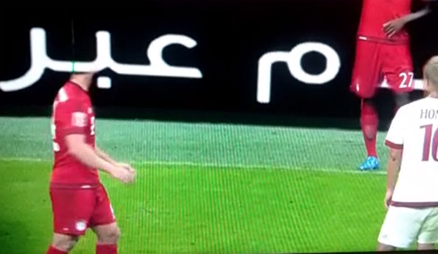 Xabi Alonso stratil v zápase proti AC Miláno hlavu, a to doslova! (VIDEO)