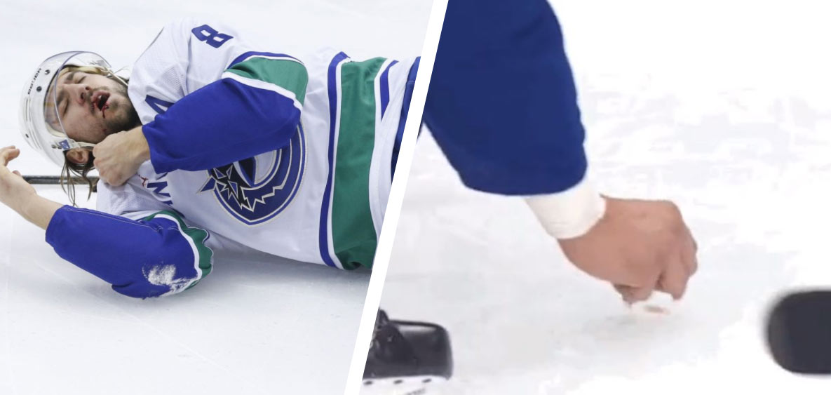 Tomu sa povie spoluhráč: Hokejistu Vancouveru trafil puk do tváre. Spoluhráč mu potom zbieral z ľadu zuby! (VIDEO)