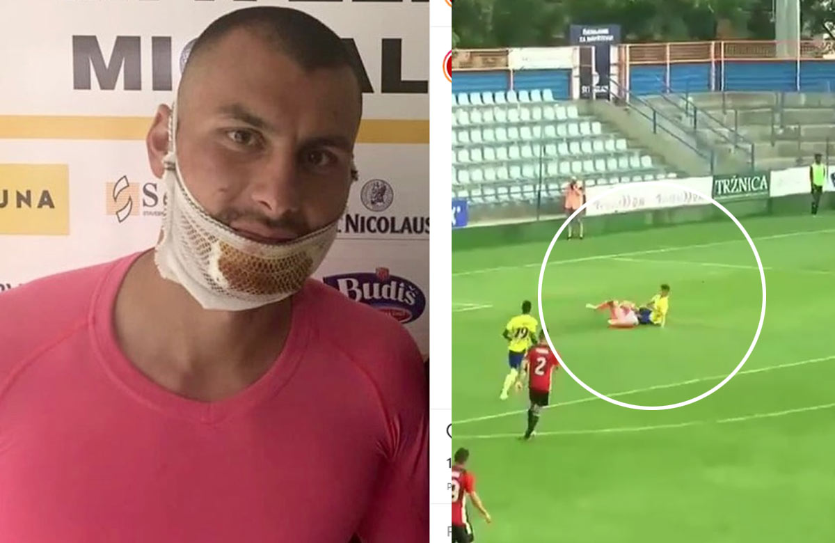 Hrozivé zranenie brankára Spartaka Trnava (VIDEO)